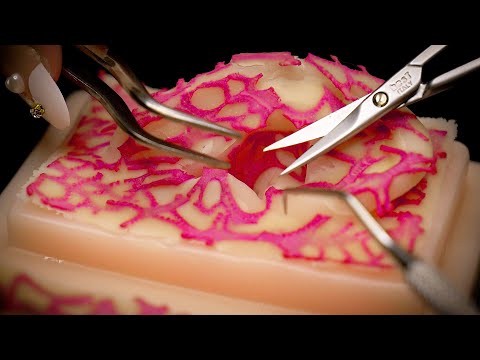 Видео: [ASMR] Удаляет ушные клетки и трубки (субтитры, барабанная перепонка, массаж, acmp)