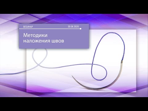 Видео: Вебинар «Анализ методик наложения швов»