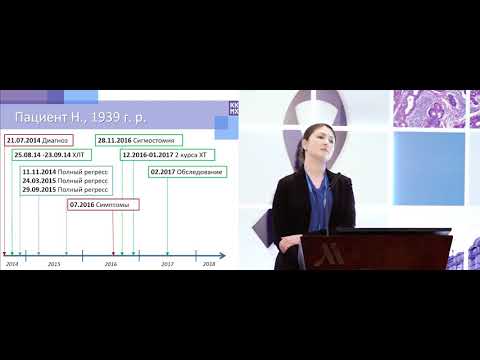 Видео: Рецидив рака прямой кишки после полного эффекта на фоне ранее проведенной ХЛТ