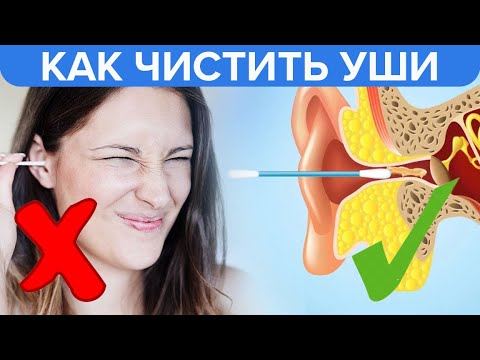 Видео: Как правильно чистить уши | Правильная гигиена ушей! - Доктор 24