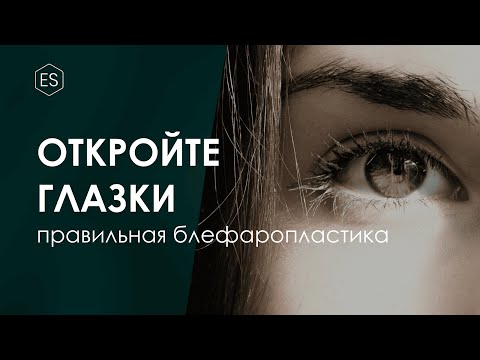 Видео: ПРАВИЛЬНАЯ БЛЕФАРОПЛАСТИКА