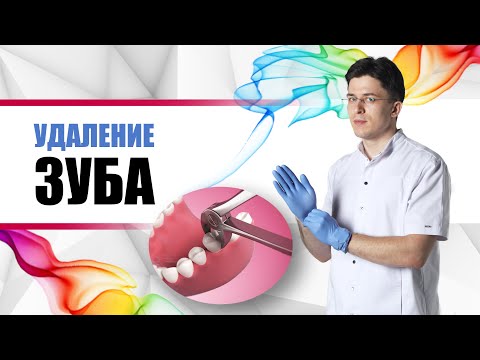 Видео: удаление зуба
