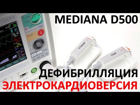 Видео: ЭЛЕКТРОКАРДИОВЕРСИЯ / ДЕФИБРИЛЛЯЦИЯ: Дефибриллятор - монитор MEDIANA D500