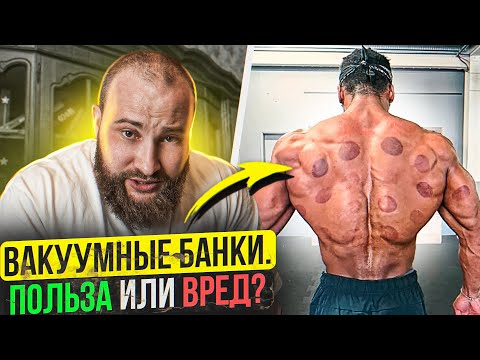 Видео: КОРОЛЕВ. Банки на спину. Зачем? Польза. Вред