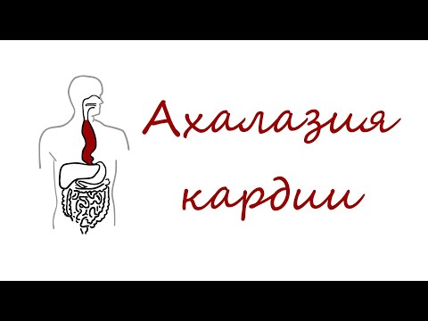 Видео: Ахалазия кардии