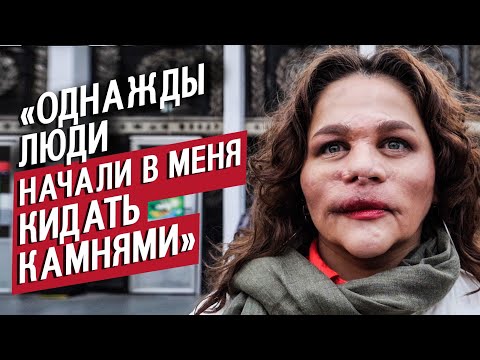 Видео: Мое лицо собрано заново: Варвара | Вопреки