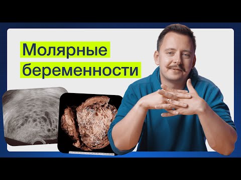Видео: Когда беременность всё-таки болезнь?