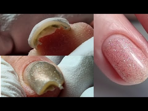Видео: НОВАЯ клиентка с НЕПЕРЕНОСИМЫМИ ногтями // COSMOPROFI