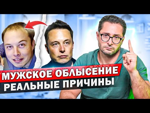 Видео: Мужское облысение. Что делать при выпадении волос? Причины и виды лечения.