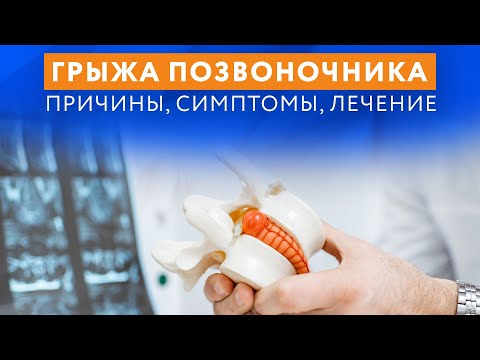 Видео: Причины, симптомы и лечение грыж // #zdravclinic
