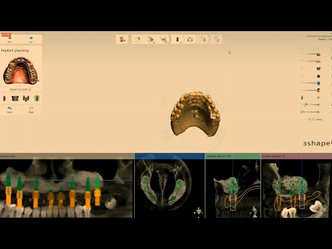 Видео: Испытание. Всегда ли можно сделать подкову? Герман Галуччи Жао Карамес