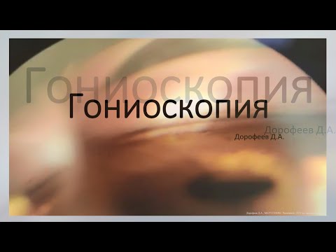 Видео: Гониоскопия 3/3