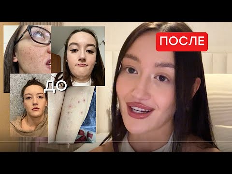 Видео: как ТЕЛЕСНАЯ ТЕРАПИЯ изменила мою внешность и жизнь 
