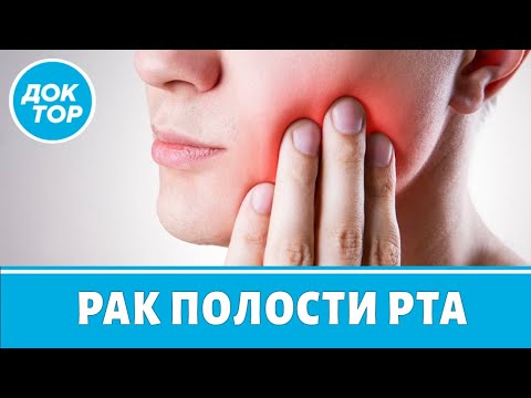 Видео: Причины появления рака в полости рта