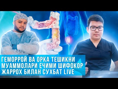Видео: Геморрой касаллиги ва орка тешик  муаммолари сабаблари ва давоси// шифокор хирург билан сухбат