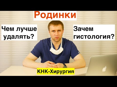 Видео: Чем лучше удалять родинки?