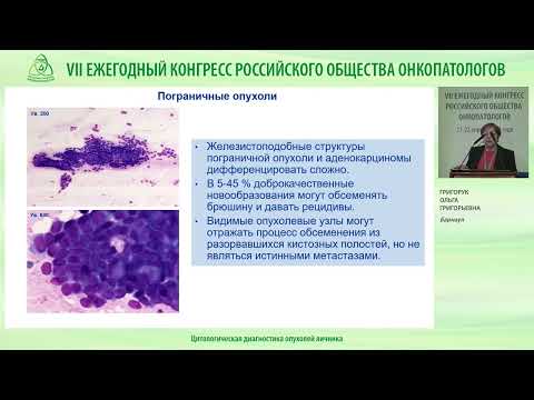 Видео: Цитологическая диагностика опухолей яичника