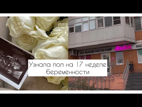 Видео: 17-АЯ НЕДЕЛЯ БЕРЕМЕННОСТИ | ДНЕВНИК БЕРЕМЕННОСТИ | УЗНАЛА ПОЛ ❤️ | ПЕРЕЗД