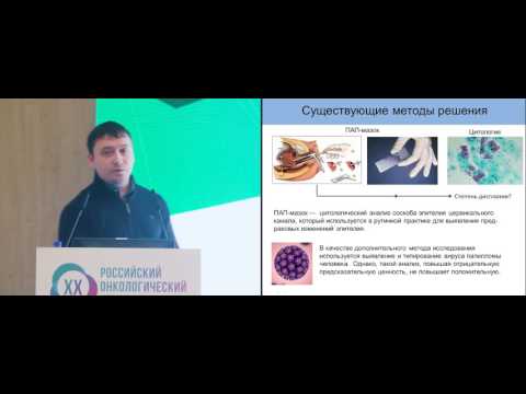 Видео: Тест-системы на основе микроРНК-профилирования для первичной и дифференциальной диагностики РШМ