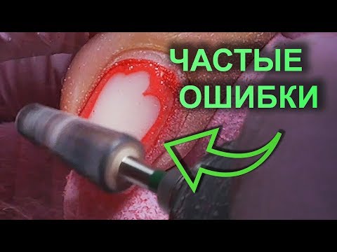 Видео: СНЯТИЕ ГЕЛЬ-ЛАКА ФРЕЗОЙ l частые ОШИБКИ МАСТЕРОВ маникюра