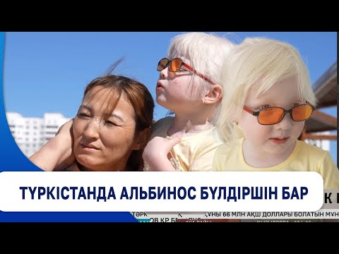 Видео: Түркістанда альбинос бүлдіршін бар