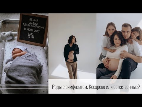 Видео: Мои третьи роды. Симфизит. КС или ЕР?