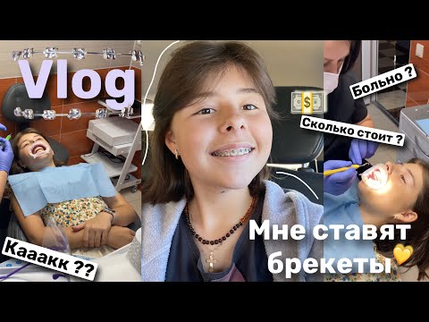 Видео: МНЕ СТАВЯТ БРЕКЕТЫ / vlog 💛/ Sofia Kamenskay ✨