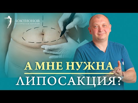 Видео: Изучите ЭТИ вопросы, перед тем как сделать липосакцию! Как избавиться от жира с помощью липосакции