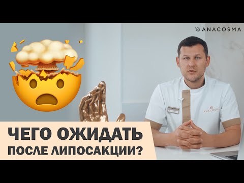 Видео: РЕАБИЛИТАЦИЯ ПОСЛЕ ЛИПОСАКЦИИ: К ЧЕМУ ГОТОВИТЬСЯ⁉️🔥