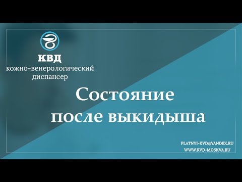 Видео: 752  Состояние после выкидыша