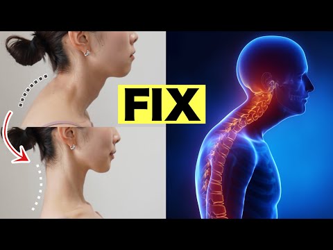 Видео: Как исправить горб на шее｜Можно делать сидя