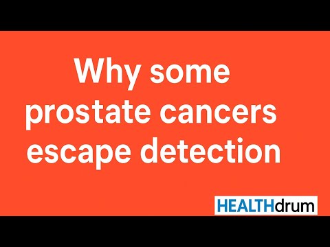 Видео: Почему некоторые виды рака предстательной железы не обнаруживаются?:: Рак, ускользающий от обнару...