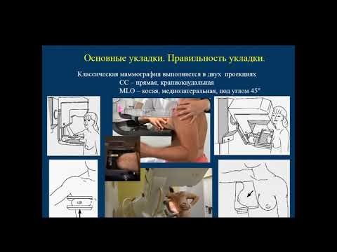 Видео: Шумакова Т.А. "Принципы и критерии качества маммографического исследования"