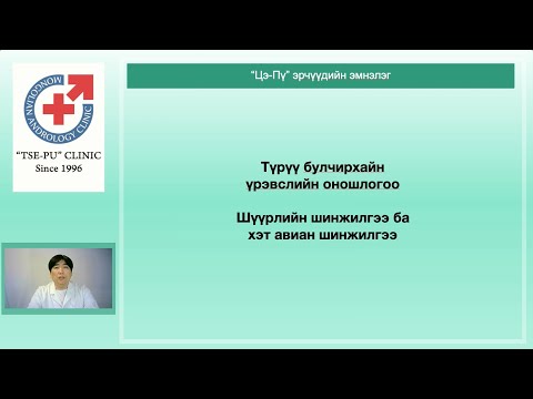 Видео: Түрүү булчирхайн үрэвслийн оношлогоо шинжилгээ 1