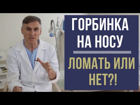 Видео: ГОРБИНКА НА НОСУ: ❗️❗️❗️КОГДА ЛОМАТЬ, А КОГДА - НЕТ?!