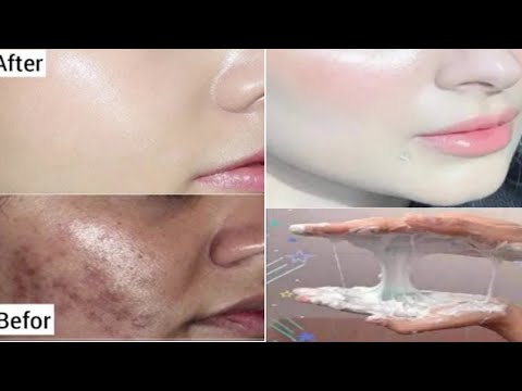 Видео: Очень быстрое отбеливание лица и тела 🌼 Формула,вдохновленная Кореей, сделает вашу кожу белой, как