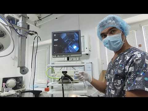 Видео: Баллонная дилатация пищевода у кота с помощью эндоскопа.