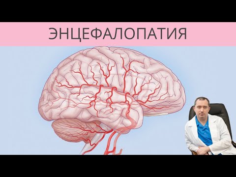 Видео: Энцефалопатия. От чего с возрастом развивается энцефалопатия?