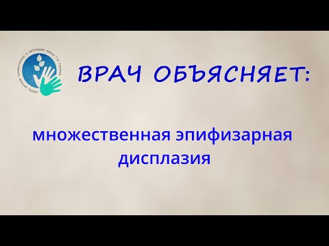 Видео: Лечение множественной эпифизарной дисплазии в НМИЦ им. Г. И. Турнера