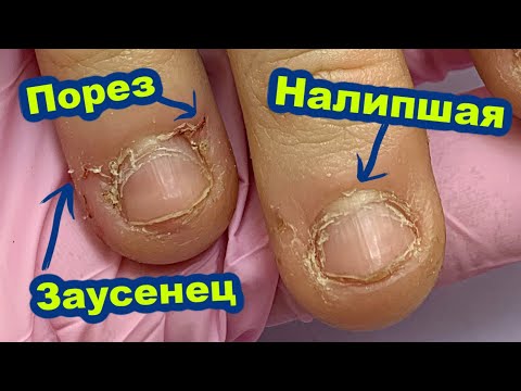 Видео: Обкусанные Ногти Преображаем до НЕУЗНАВАЕМОСТИ! Вопросы о Наращивании Ногтей