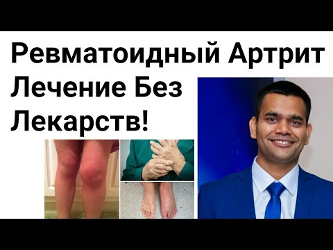 Видео: Ревматоидный Артрит- Лечение Без Лекарств