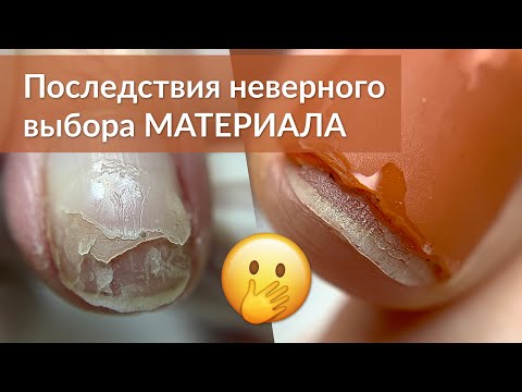 Видео: Укрепление ногтей Базой или Гелем - Что Лучше!?
