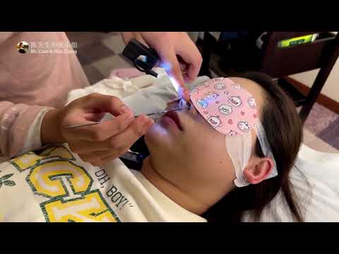 Видео: ASMR чистка носа
