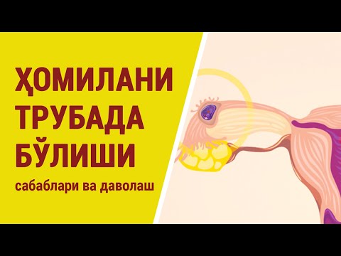 Видео: Ҳомилани трубада бўлиши