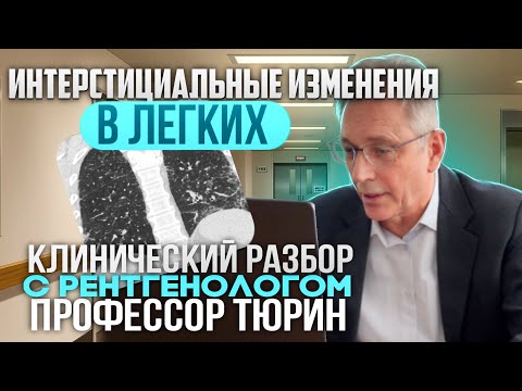 Видео: Клинические разборы с рентгенологом. Профессор Тюрин. 18 января 2024. Интерстициальные изменения.