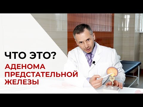 Видео: Аденома предстательной железы  | Что это?  |  Как лечить аденому предстательной железы