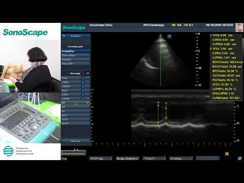 Видео: Мастер-класс на аппарате SonoScape S8Exp. Лектор: Рыбакова М.К.