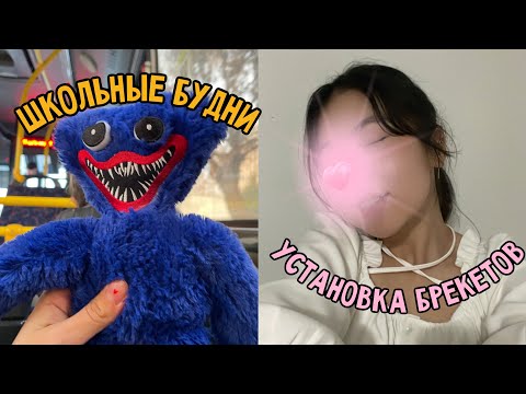 Видео: ВЛОГ//ШКОЛЬНЫЕ БУДНИ//СТАВЛЮ БРЕКЕТЫ