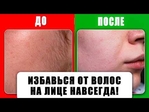 Видео: Волосы на лице! Самый простой и действенный способ избавиться легко! 