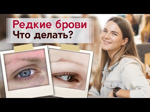 Видео: Перещипанные и редкие брови Что делать? | Как происходит перещипывание бровей?